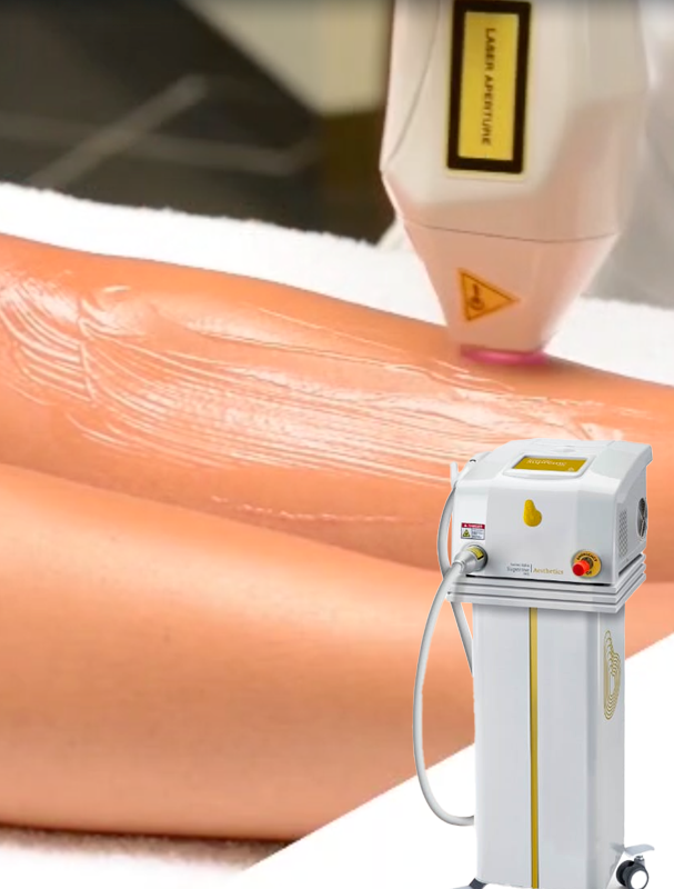 epilazione laser diodo macchinario tecnologico